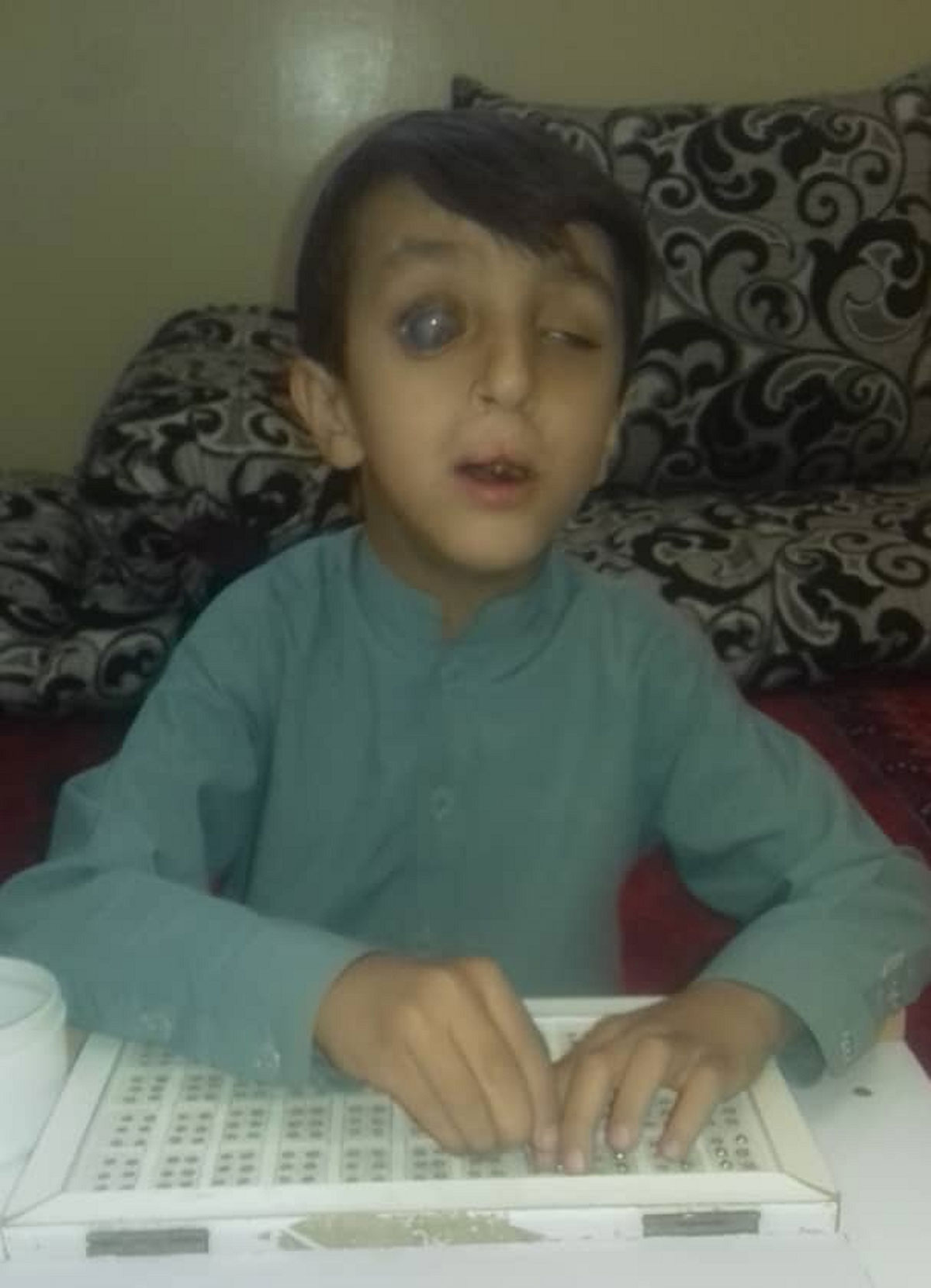 Inclusive education for children with disabilities serve afghanistan